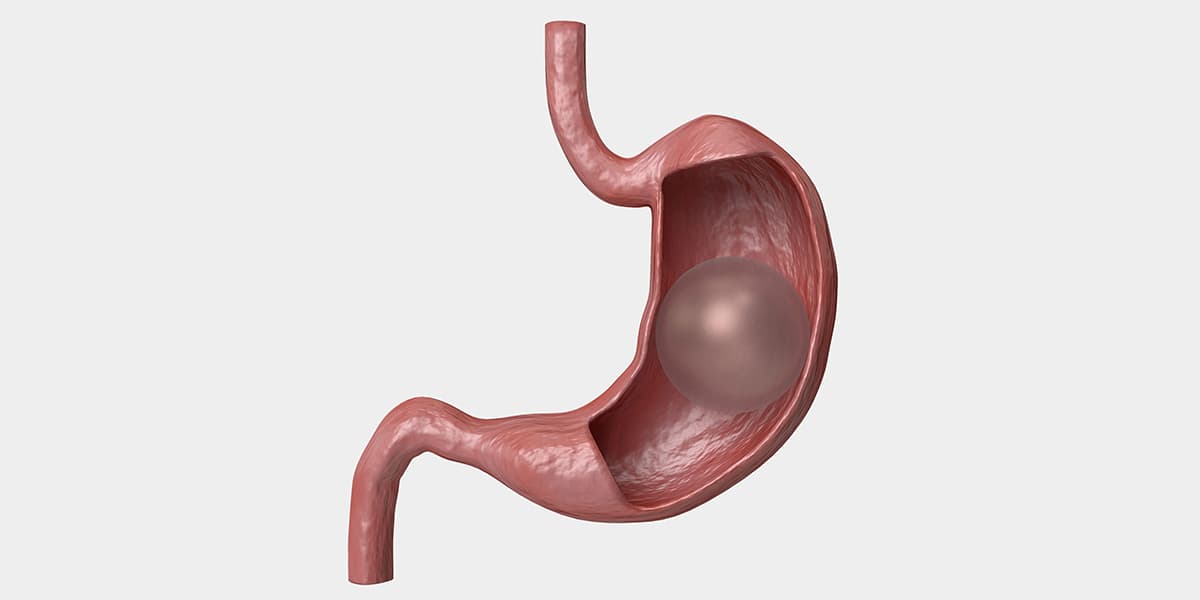 Endoskopik Obezite Tedavileri